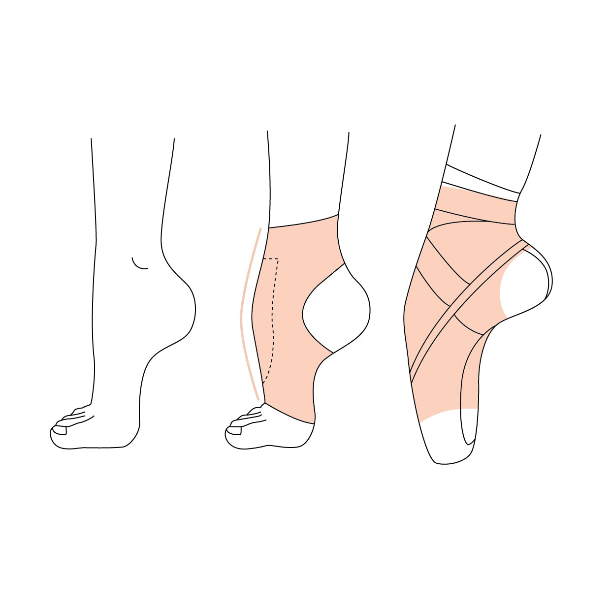 Silicone Arch Booster